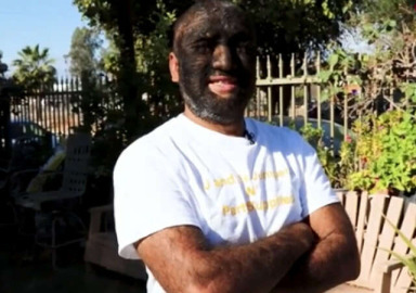 O dünyanın en kıllı adamı