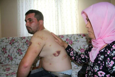 Sosyal medyada tanıştığı kadının tuzağına düştü! İşkence yaptılar