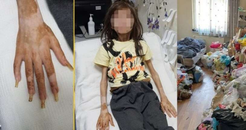 Çöp evde bulunan Cem Muhammet, artık sağlıklı ve mutlu