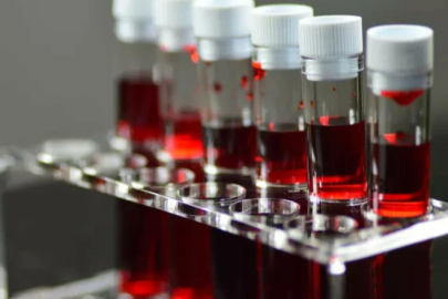 Kan grubunun en zekisi belli oldu!