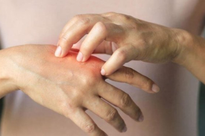 El ağrılarında doğru tanı tedavide önemli