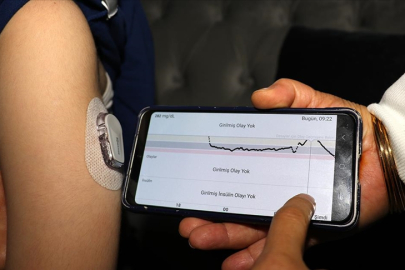 Diyabet yönetiminde yapay zeka hastaların yaşam kalitesini artırıyor