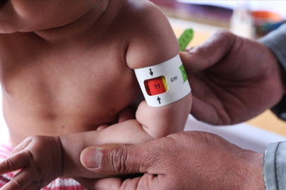 Save The Children: Bu yıl en az 17,6 milyon çocuk açlık içinde doğacak