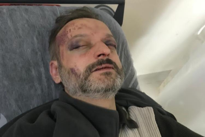 Çiftetelli çalmadı, öldüresiye dövüldü..