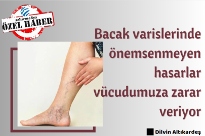 Bacak varislerinde önemsenmeyen hasarlar vücudumuza zarar veriyor