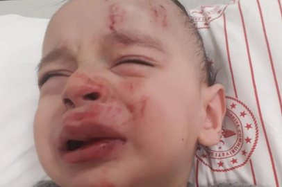 Kızını sokak köpeklerinden korurken kucağındaki cocuğunu düşürdü