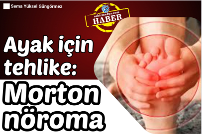​Ayak için tehlike: Morton nöroma