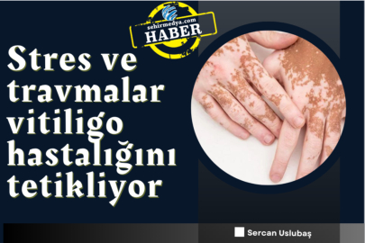 Stres ve travmalar vitiligo hastalığını tetikliyor