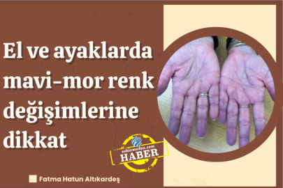 El ve ayaklarda ani mavi-mor renk değişimlerine dikkat