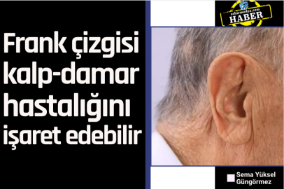 Frank çizgisi kalp-damar hastalığını işaret edebilir