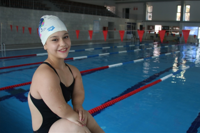 Rehabilitasyon için başladığı yüzmede Paris Paralimpik Oyunları'na katılmaya hak kazandı