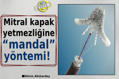 Mitral kapak yetmezliğine “mandal” yöntemi! 