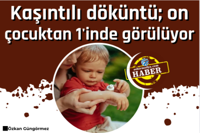 Kaşıntılı döküntü; on çocuktan 1'inde görülüyor