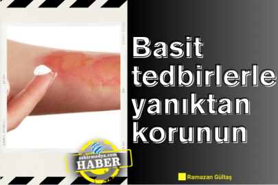 Basit tedbirlerle yanıktan korunun