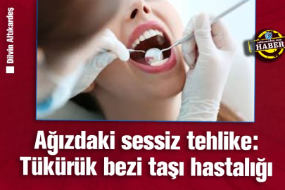 Ağızdaki sessiz tehlike: Tükürük bezi taşı hastalığı
