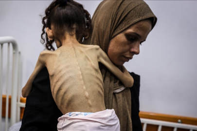 İsrail’in kıtlığa sürüklediği Gazze’de 9 yaşındaki Meryem, 25 kilodan 10 kiloya düştü