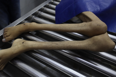 İsrail'in kıtlığı dayattığı Gazze'de son 24 saatte 3 kişi daha açlıktan hayatını kaybetti