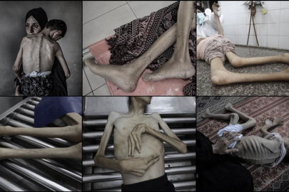 İsrail'in kıtlığı dayattığı Gazze'de ağustos ayında 185 kişi açlıktan yaşamını yitirdi