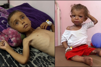 Gazzeli çocuklar hastanelerde ölümü bekliyor