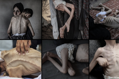 İsrail, 2 yıldır sürdürdüğü soykırımda Filistinlileri sadece silahla değil "açlıkla" da öldürüyor