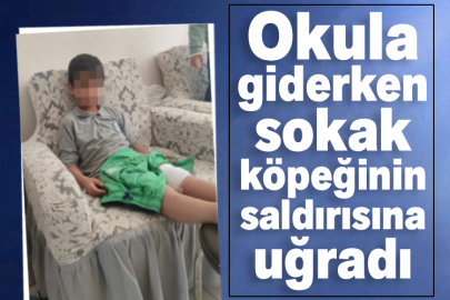 Okula giderken sokak köpeğinin saldırısına uğradı