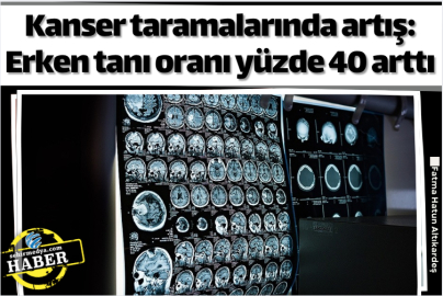 Kanser taramalarında artış: Erken tanı oranı yüzde 40 arttı