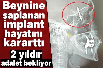 Beynine saplanan implant hayatını kararttı! 2 yıldır adalet bekliyor
