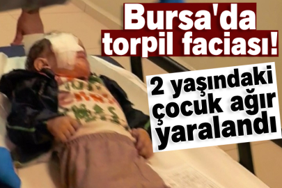 Bursa'da torpil faciası! 2 yaşındaki çocuk ağır yaralandı