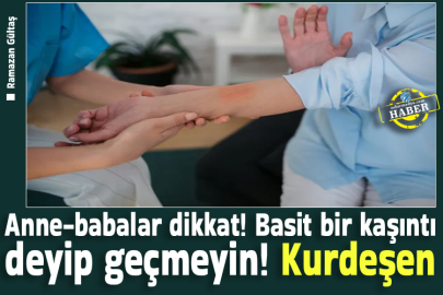 Anne-babalar dikkat! Basit bir kaşıntı deyip geçmeyin! Kurdeşen