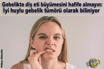 Gebelikte diş eti büyümesini hafife almayın: İyi huylu gebelik tümörü olarak biliniyor 