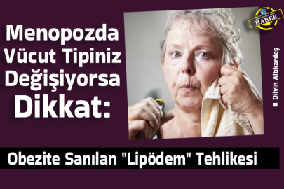 Menopozda Vücut Tipiniz Değişiyorsa Dikkat: Obezite Sanılan "Lipödem" Tehlikesi