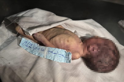 Gazze'de şiddetli soğuk nedeniyle bir aylık bebek hayatını kaybetti