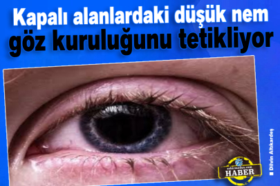 Kapalı alanlardaki düşük nem göz kuruluğunu tetikliyor