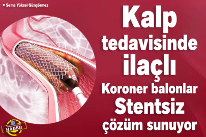 Kalp tedavisinde ilaçlı Koroner balonlar Stentsiz çözüm sunuyor