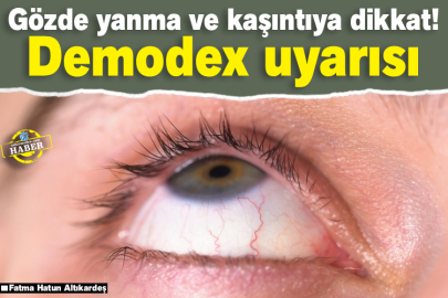 Gözde yanma ve kaşıntıya dikkat! Demodex uyarısı
