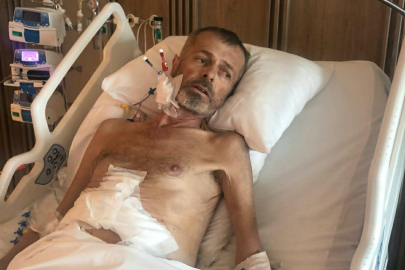 Kızının karaciğeri ile hayata tutundu