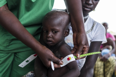 Küresel yardım kesintileri 2030’a kadar 9,4 milyon ilave ölüme yol açabilir