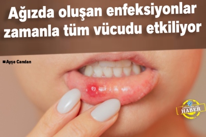 Ağızda Oluşan Enfeksiyonlar Zamanla Tüm Vücudu Etkiliyor