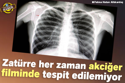 Zatürre her zaman akciğer filminde tespit edilemiyor