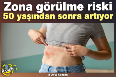 Zona görülme riski 50 yaşından sonra artıyor