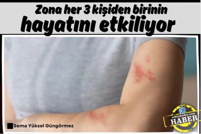 Zona her 3 kişiden birinin hayatını etkiliyor  