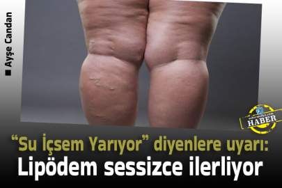 “Su İçsem Yarıyor” diyenlere uyarı: Lipödem sessizce ilerliyor