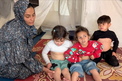 Gazze'de kamplarda yaşamaya zorlanan Filistinliler su sıkıntısı nedeniyle cilt hastalıklarına yakalanıyor