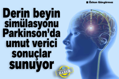 Derin beyin simülasyonu Parkinson’da umut verici sonuçlar sunuyor