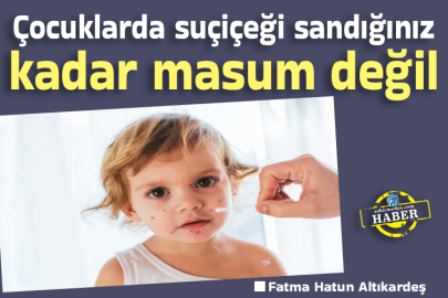 Çocuklarda suçiçeği sandığınız kadar masum değil