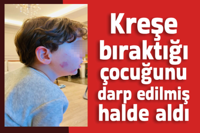 Kreşe bıraktığı çocuğunu darp edilmiş halde aldı