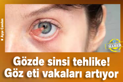 Gözde sinsi tehlike! Göz eti vakaları artıyor
