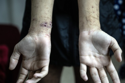 Filistin İnsan Hakları Merkezi: Filistinli esirlere yönelik ihlallerde benzeri görülmemiş artış var