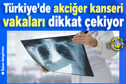 Türkiye’de akciğer kanseri vakaları dikkat çekiyor