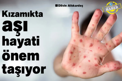 Kızamıkta aşı hayati önem taşıyor 